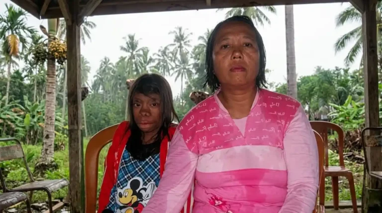 Foto potret ibu dan anak, Seftiani, gadis Indonesia dengan kondisi kraniofasial unik, duduk bersama di bawah pendopo dengan latar kebun kelapa.